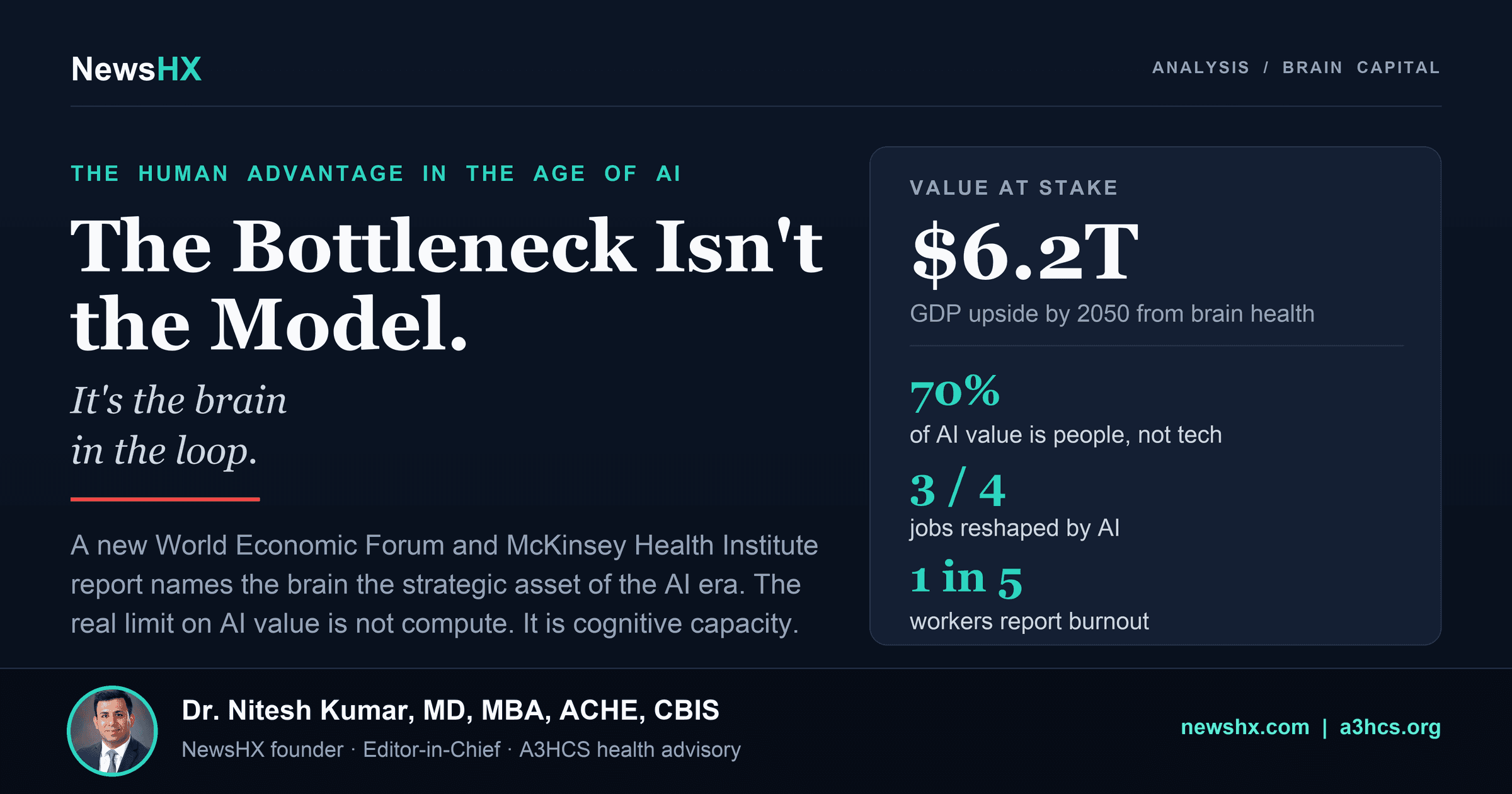 The Bottleneck Isn't the Model. It's the Brain.